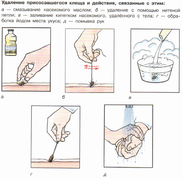 Реферат: Клещевой энцефалит и защита от него